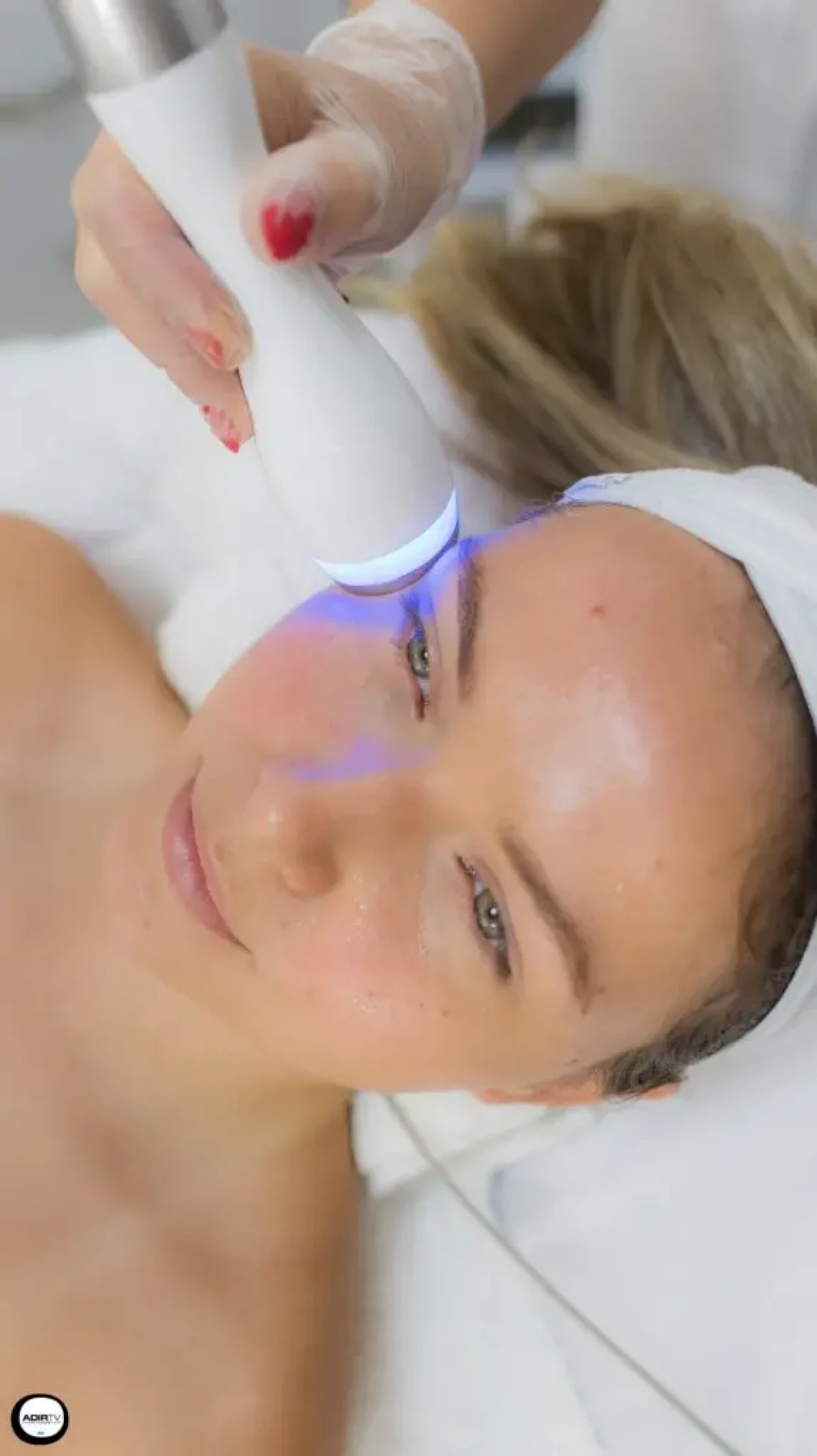 Cryothérapie & Radiofréquence visage Bruguières