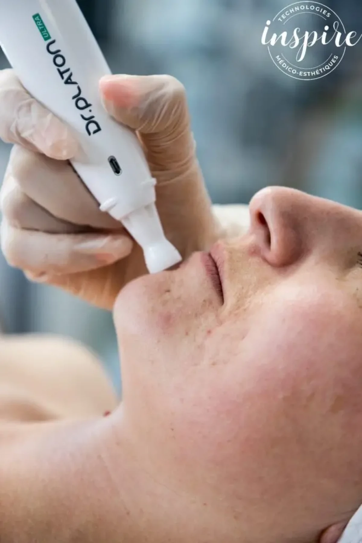 Soins visage Plasma froid Bruguières